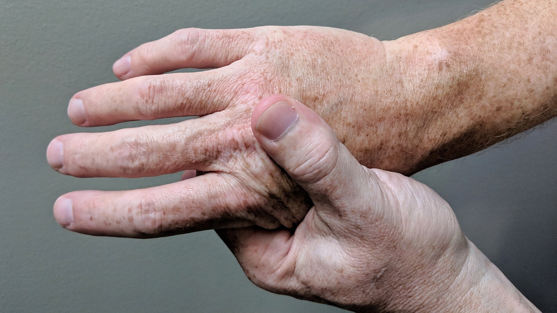 Arthrose : les solutions naturelles qui soulagent